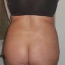 12/01/08 day before surgery.