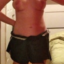 mid week 2 post op, top of stomach/rib cage swelled up a bit