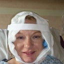 Day of operation - 2 hours after