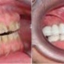 Before and After photos....just amazing.
