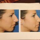 Print out from my consult with Dr. Lin.