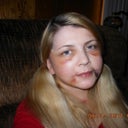 This is another after picture. This year today August 24 2012. My throat is still tight and I think I will have to have one of my earlobes looked at. Overall, I am  pleased!