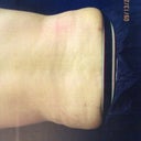 Love Handles - Nearly gone! Sooooo happy!