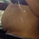 Pre op