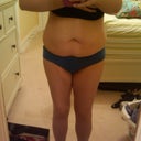 3 1/2 weeks pre-op, front view