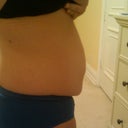 3 1/2 weeks pre-op, right side view
