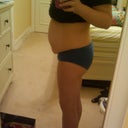 3 1/2 weeks pre-op, right side view