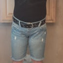 Pre-op in clothes