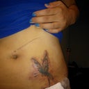 A day after first session. It's pretty much a burn. The session itself hurt but not afterwards like some people say.
