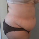Before - Side 1 - 5/8/12