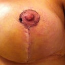 left boob