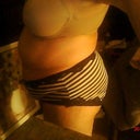 Pre-SurgerySide-4.11.11