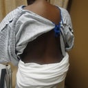 DAY OF SURGERY - Back Rolls