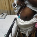 DAY OF SURGERY - TUMMY