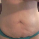 The unsightly pouch before. I'm not going to miss it!!
