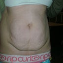 Before, front, yuck!!