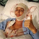 I am going to post the pics of my Face lift here also just to let folks see what it was like for me. This pic is the day of my FL. home from the operation. I also had a breast implant exchange done with my FL to remove 25 year old implants that were ruptured. This was a long recovery. I would have to honestly say I did not feel like myself for a good 4-5 months after the operations. A lot of down time. Im glad I did it, I would do it all again, but know this is MAJOR SURGERY. Not to be taken lightly. There is really no pain, just discomfort and a lot of frustration with the ups and downs of the healing process. Good luck to all of you out there on your cosmetic adventures :) FYI: The total for the FL,neck lift, brow lift, fat transfer, breast reconstruction, botox, filler and Fraxsal has come to a whopping $35,000.00 . Yes, CRAZY I know. (This was a new car, a VERY nice new car....But I don't care about cars. So this is my new ride:) Also, have people who love and support you in this quest. You'll need them to be there for you and be understanding as you transform yourself. I have been married for 25 years and have been a stay at home mom of 5 great kids for 23 of those, my family was amazing and really helped me through this journey. I am blessed.