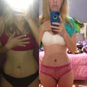 Post op 7 days then post op 11 days