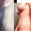 Before and afters. Love these.