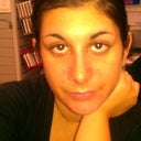 A few hours after the cast was taken off....the swelling had begun