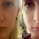 before and after front