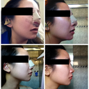 Top row: Day 2, Day 4; 
Bottom row: Day 7, Day 10