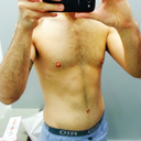 Post Op - 3 months