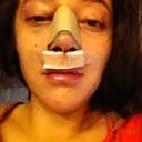 Post Op- Day 1
