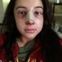 Post Op- Day 2