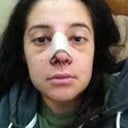 Post Op- Day 3