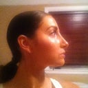side view around 4 weeks post op.