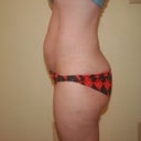 notice the pregnant looking belly