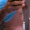 Post Op - Day 5 - Side view is starting to flatten out which is nice.