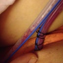 Drains ouch and double yuk