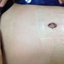 New belly button