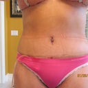 12 days po front