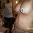 still swollen, dont mind the other faces...dont know how to block em out?? 