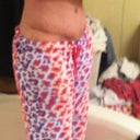 6 weeks post op