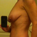 5 nites before surgery.  I love my upper arms but I adhor my chest.