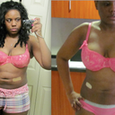 06 March 2010 - Results from Smart Lipo touch up on 22 Feb 2010