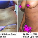 26 March 2010 After Touch Up Comparison Picture