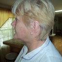 SIDE VIEW STILL SWELLING