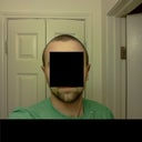 after (with the telephone C shape)