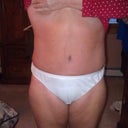 bending, still swollen, but getting therel
