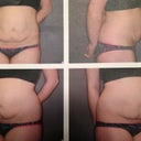 PS's before photos. Gross.