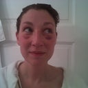 Goofy picture...bruised but no cast! and it's straight!