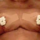 front view. see how they look like cones.