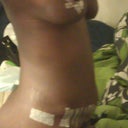 2 weeks Side 1