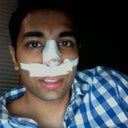Day 1 - I was so out of it, this was my "normal" face