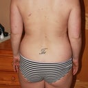 This is a before picture that I forgot to post. You can see the difference in my flank area with my after picture!